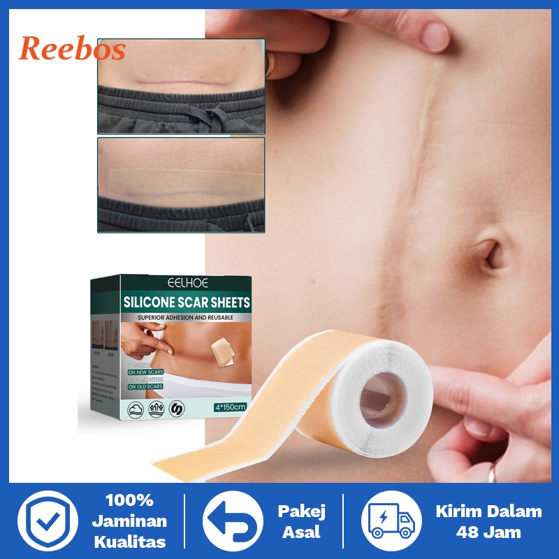 Reebos Plester Silikon Obat Bekas Luka, Jerawat, Luka Bakar & Keriput - Lembaran Perekat