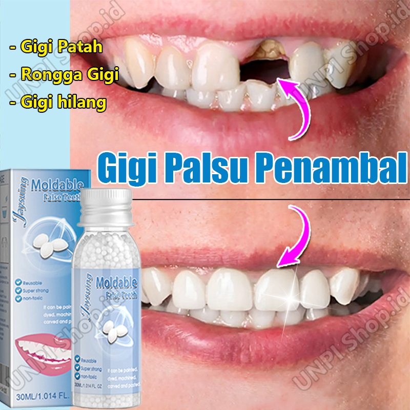 Gigi Palsu Penambal Gigi Lem Gigi Palsu Permanen Tambalan Gigi Berlubang Tambal Gigi Permanen Tempto
