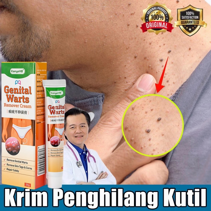 salep kutil paling ampuh  Obat kutil kelamin Pria / Wanita Penghilang  salep kutil kelamin  Penghila