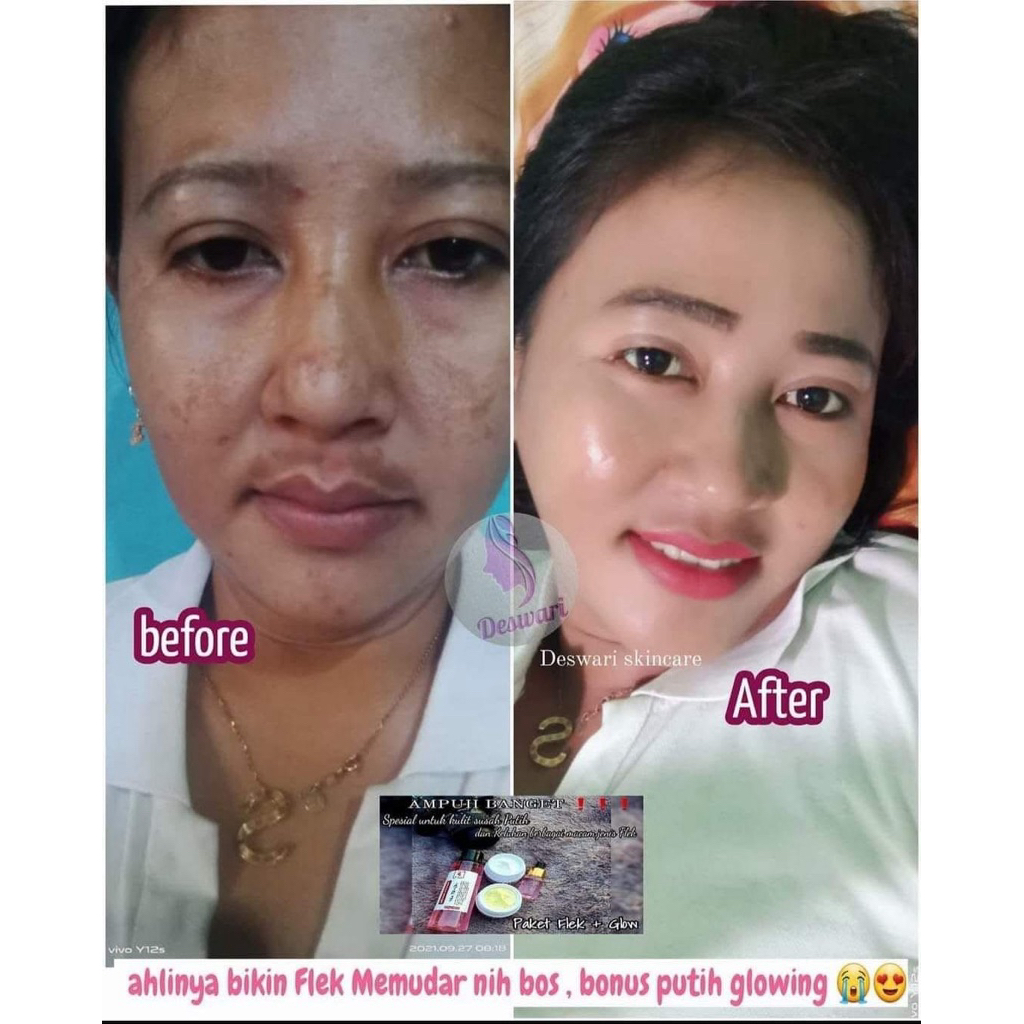 PAKET FLEK DESWARI SKINCARE