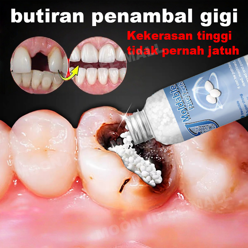 Gigi palsu Tambal gigi Penambal gigi berlubang Permanen tambal gigi Lem gigi palsu permanen Butiran 