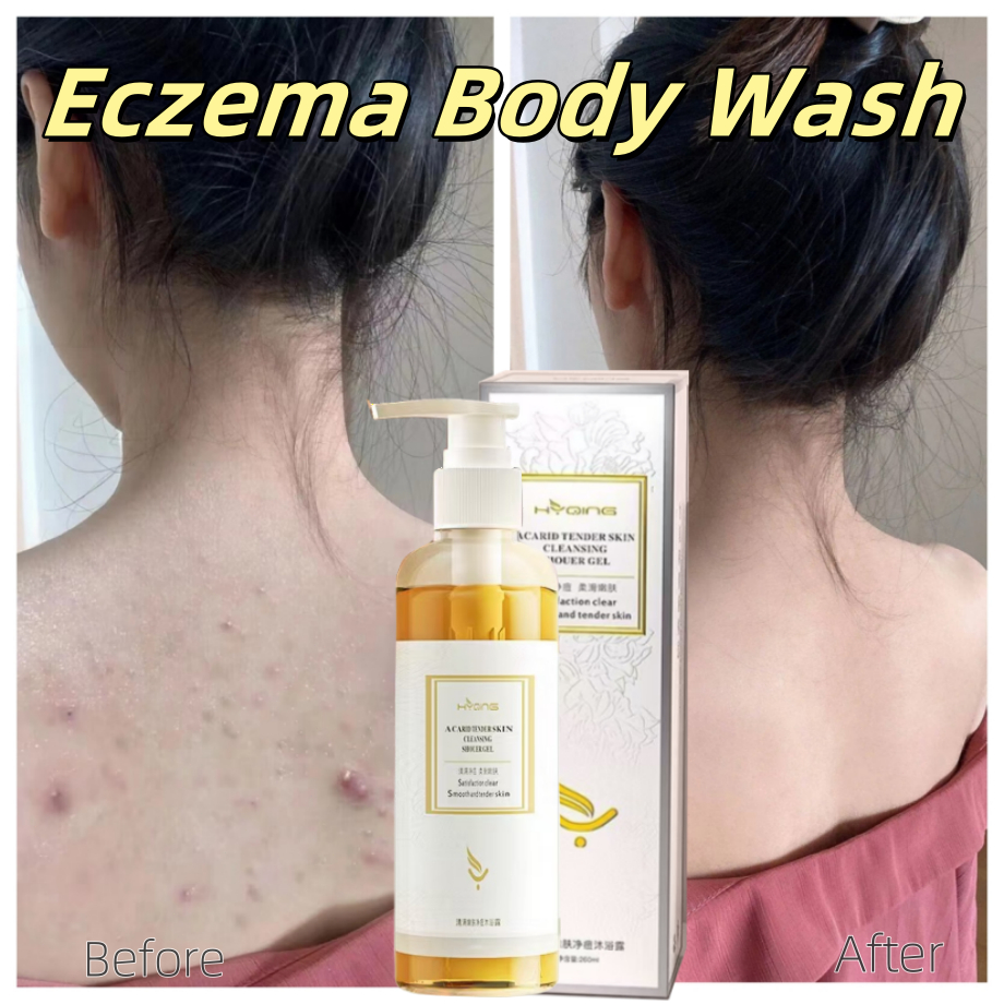 Eczema Body Wash Gatal Kulit Gel Shower Pengobatan Eksim Psoriasis Kurap Gatal Kulit Jamur Kulit Sab