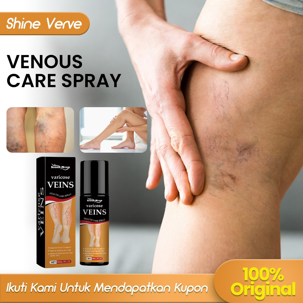 South Moon Venous Care Spray 30ml Obat Varises Varicose Veins Semprotan Perawatan Intravena Pereda O