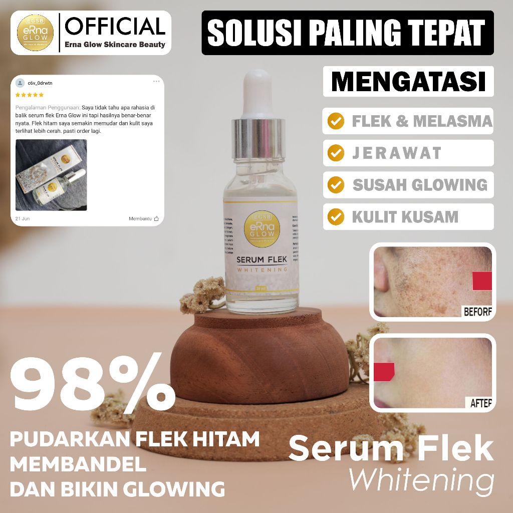 Erna Glow Skincare Beauty Serum Khusus Flek Hitam / Serum Flek Whitening Bpom / Serum Wajah Flek