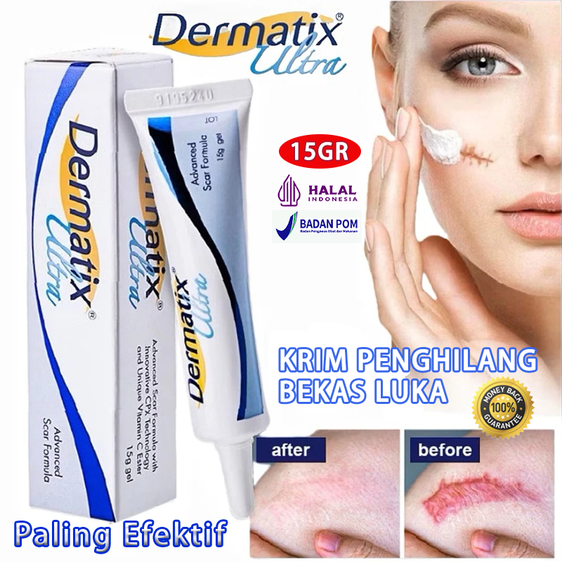 【Ready Stock】Dermatix Ultra Gel 15gr Original 100% / Dermatix Penghilang Bekas Luka