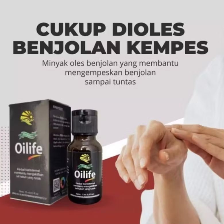 MINYAK OLES BENJOLAN PENGHILANG BENJOLAN TIROID LIPOMA KELENJAR GETAH BENING AMBEIEN AMBEYEN