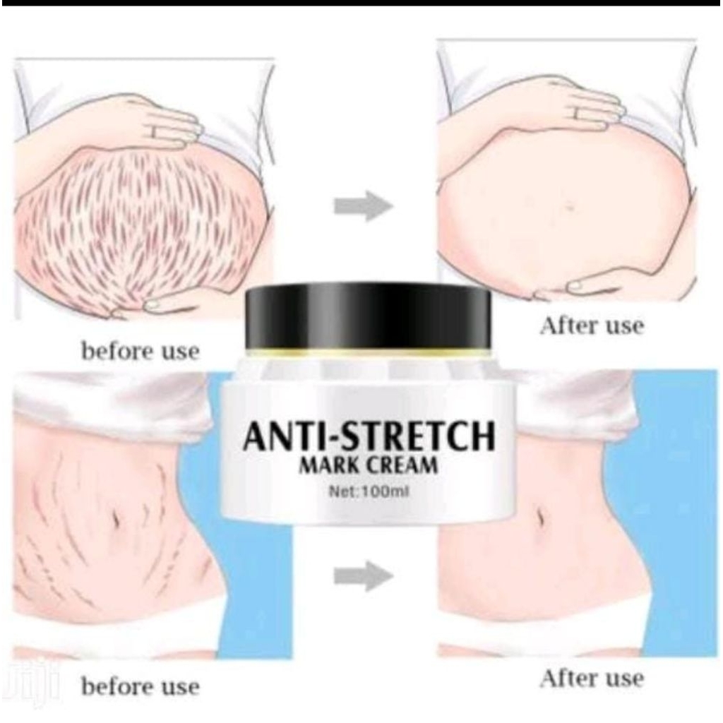 Aichun Beauty Anti Stretch Mark Cream – 100ml