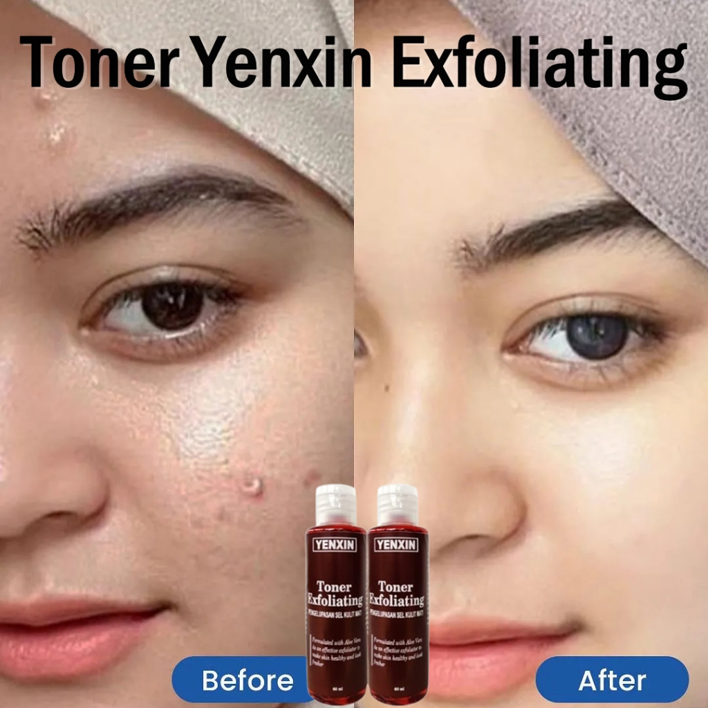 bukan Cream flek hitam membandel bpom cream penghilang flek hitam salep flek hitam membandel 30g kri