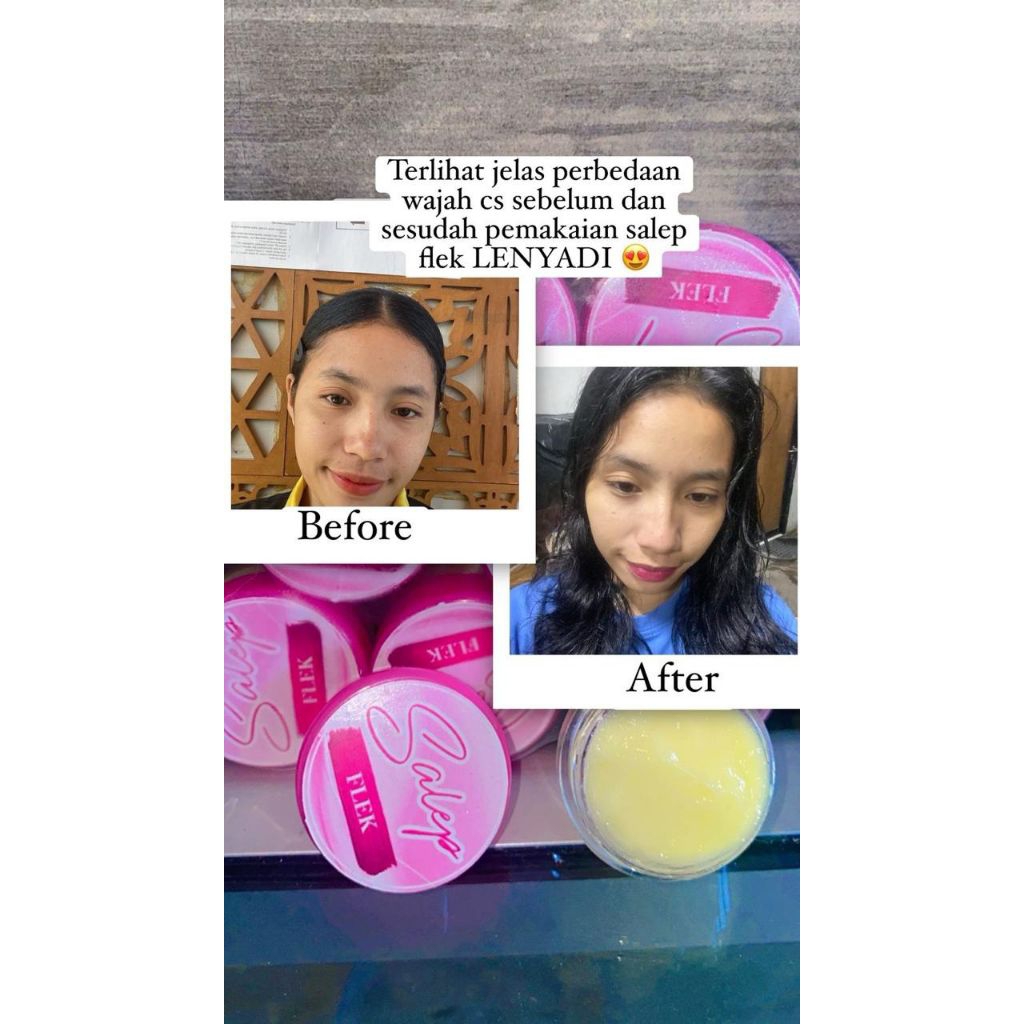 nightcream premium (Salep flek), menghilangkan flek hitam menahun, yang tebal