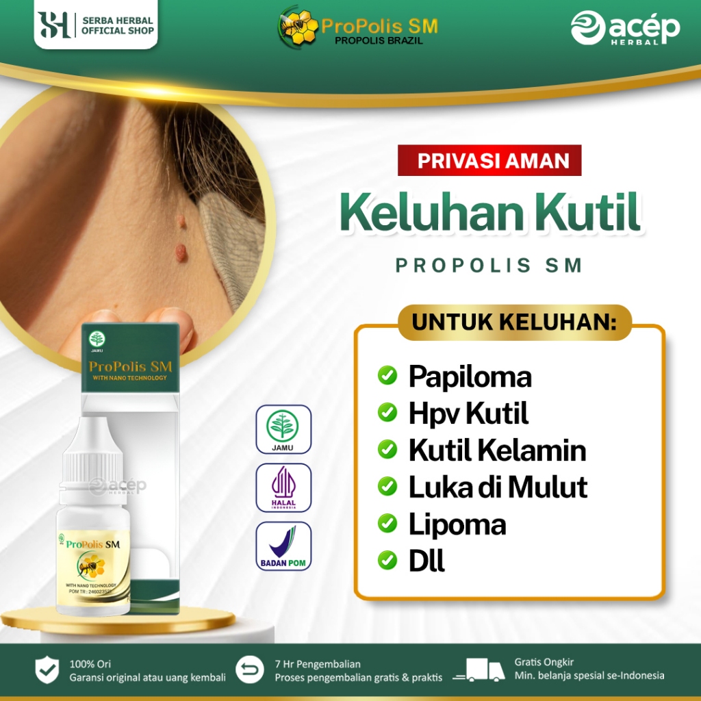 Obat Herbal Papiloma, HPV, Kutil Di Kulit/Kelamin, Daging Tumbuh, Luka Di Mulut, Lipoma, Gondok Bera