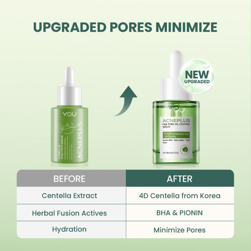 KASIR GROSIR  YOU Acne Plus Complete Solution Serum 20 ml / Serum Jerawat / Obat Jerawat You Acneplu