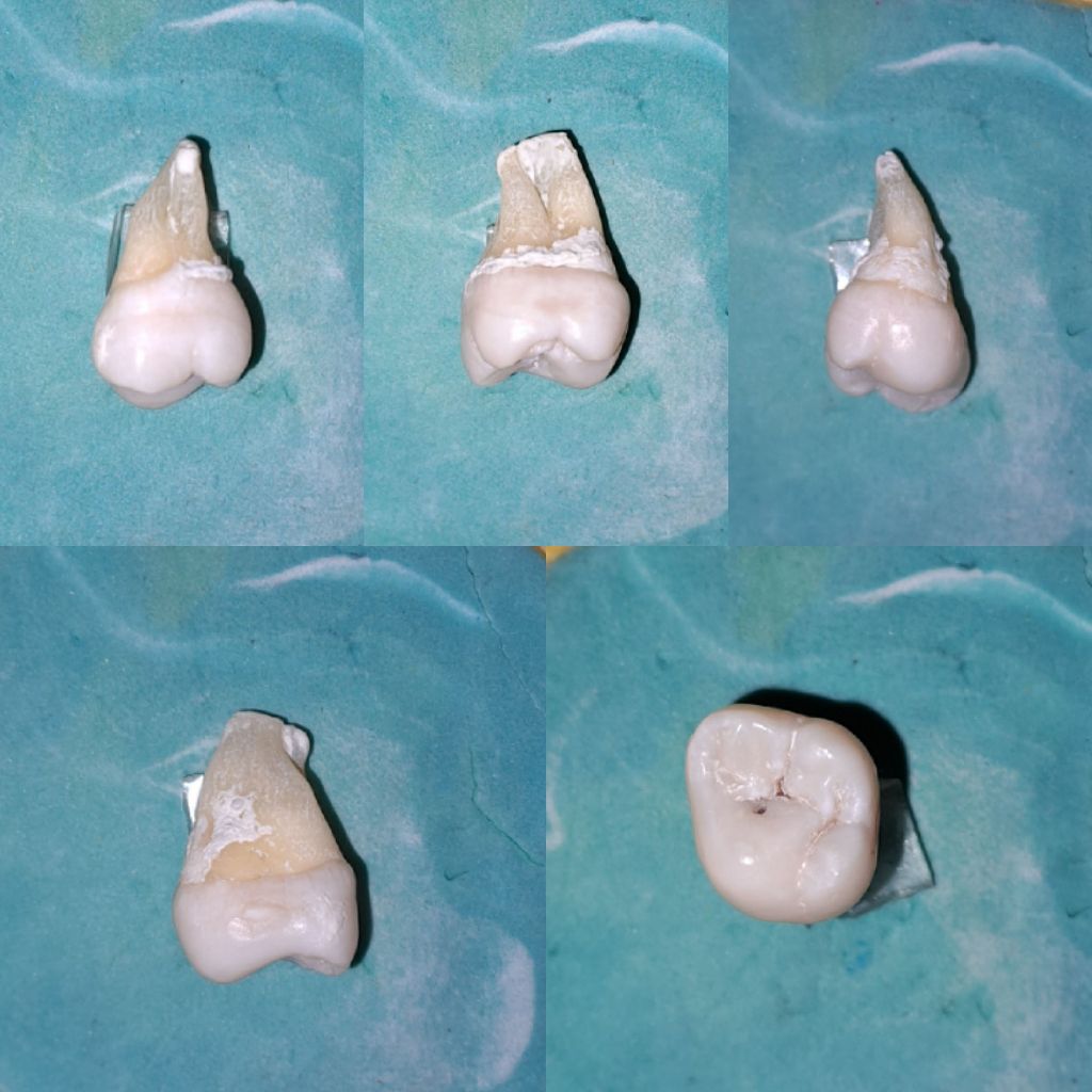 [UNSUR ASLI] Gigi Molar 3 Gigi Asli Praktikum GTJ
