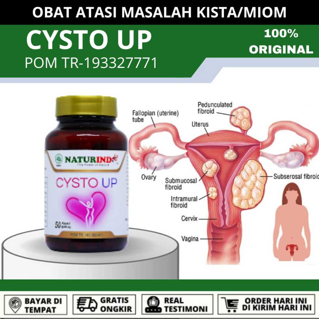 Obat Kista Myom Pelancar Haid Telat Datang Bulan Myoma Ovarium Miom Endometriosis Coklat Rahim Kanke