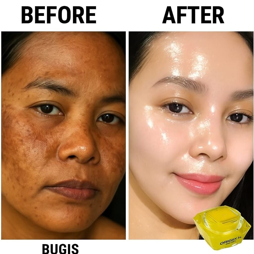 Cream flek glowing/salep flek glowing/ Cream super glowing / Salep glowing premium