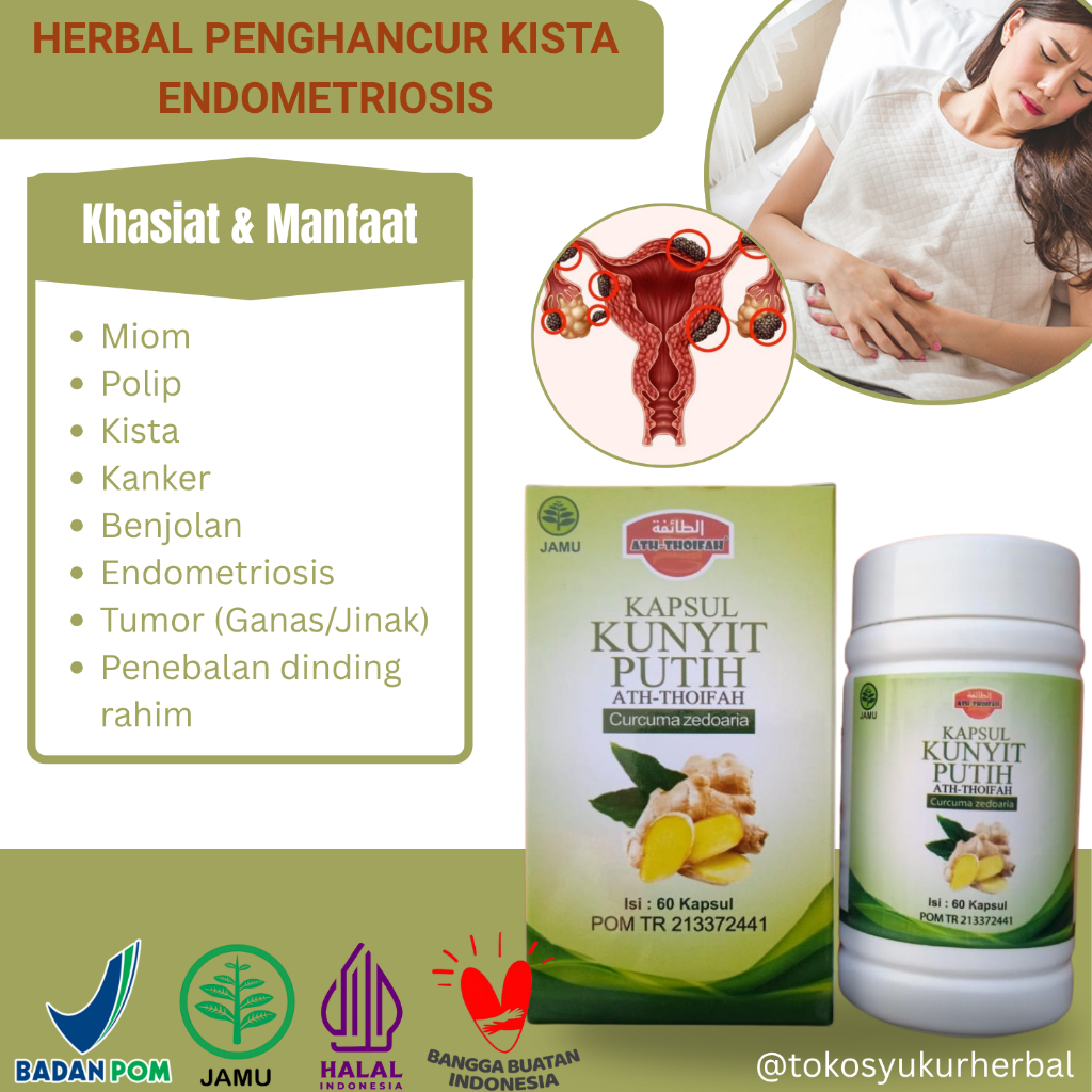 Obat Herbal Kista Endometriosis (Kista Coklat) Hilang Tanpa Operasi (BELUM ADA DI APOTIK)