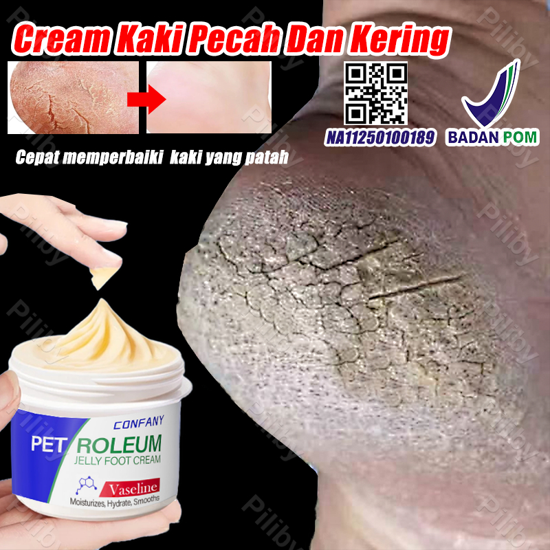 Cream Kaki Pecah Dan Kering krim tumit kaki pecah dan kering pelembab kaki kering dan pecah untuk ka