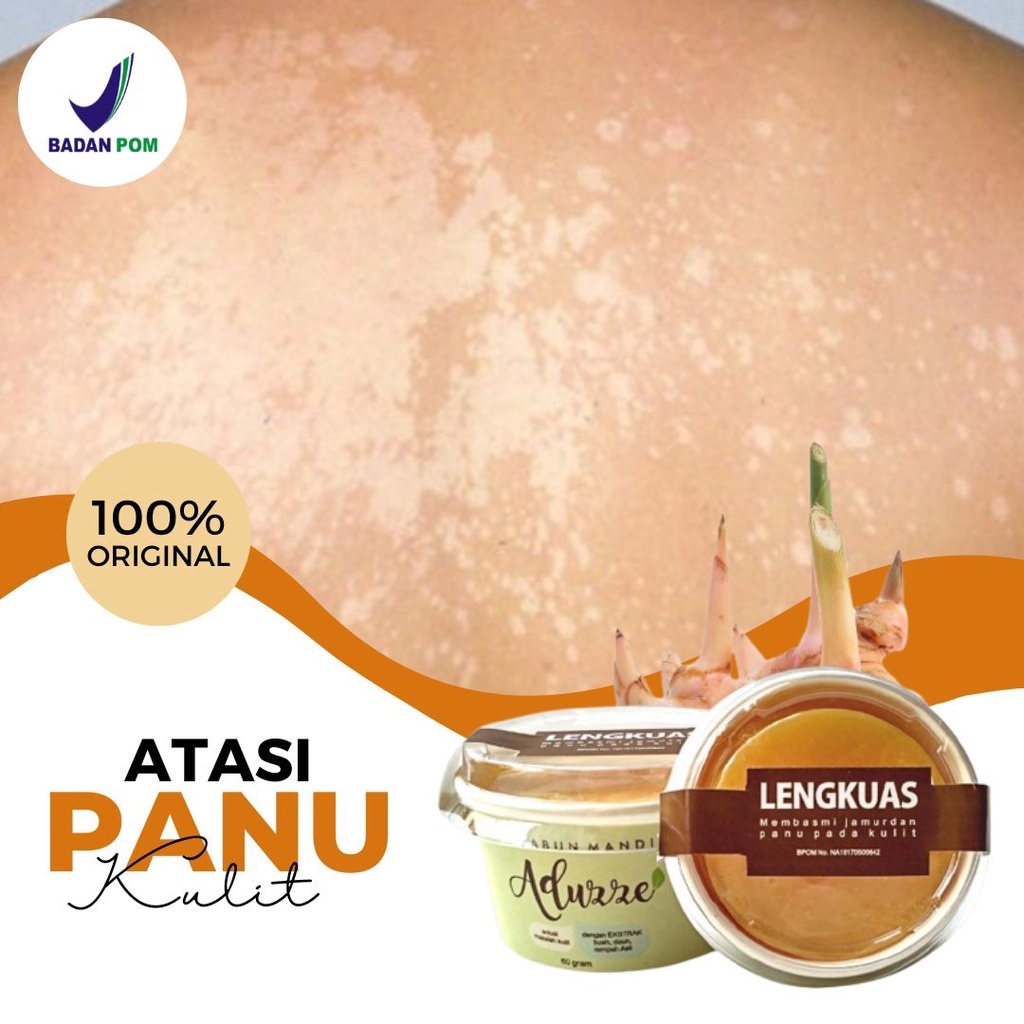 Sabun Lengkuas Penghilang Panu Di Badan Paling Ampuh 100% Cepat Hilang Sabun Gatal Gatel Kulit Yang 