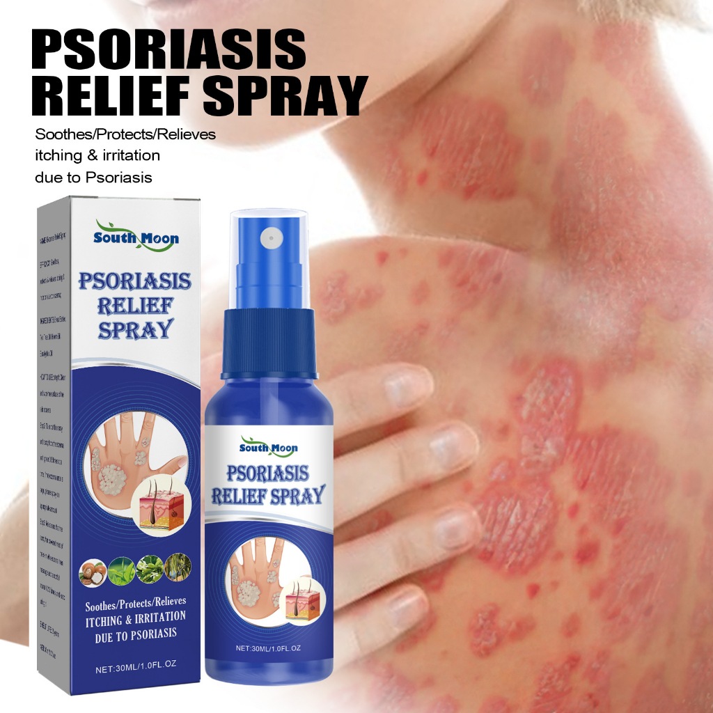 South Moon PSoriasis Relief Spray Spray Kulit Jamur Spray Eksim Menghambat Dermatitis Jamur