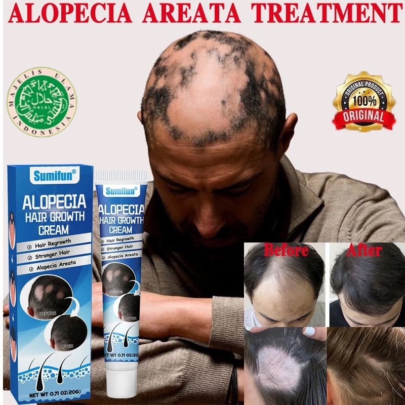 Harga alopecia Terbaru Des 2025 | BigGo Indonesia