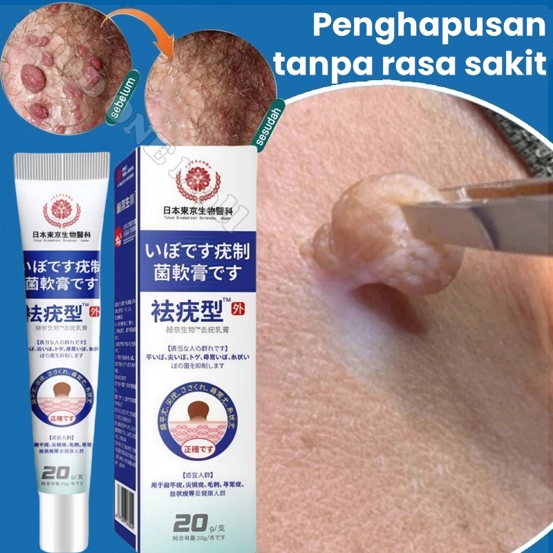 Penghilang Kutil dan Tahi Lalat Salep Kutil Paling Ampuh Obat Kutil Ampuh Ori Penghilang Tahi Lalat 