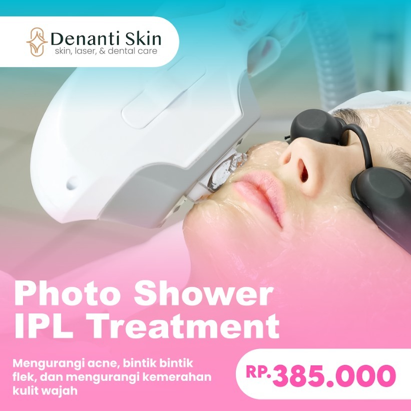 IPL TREATMENT