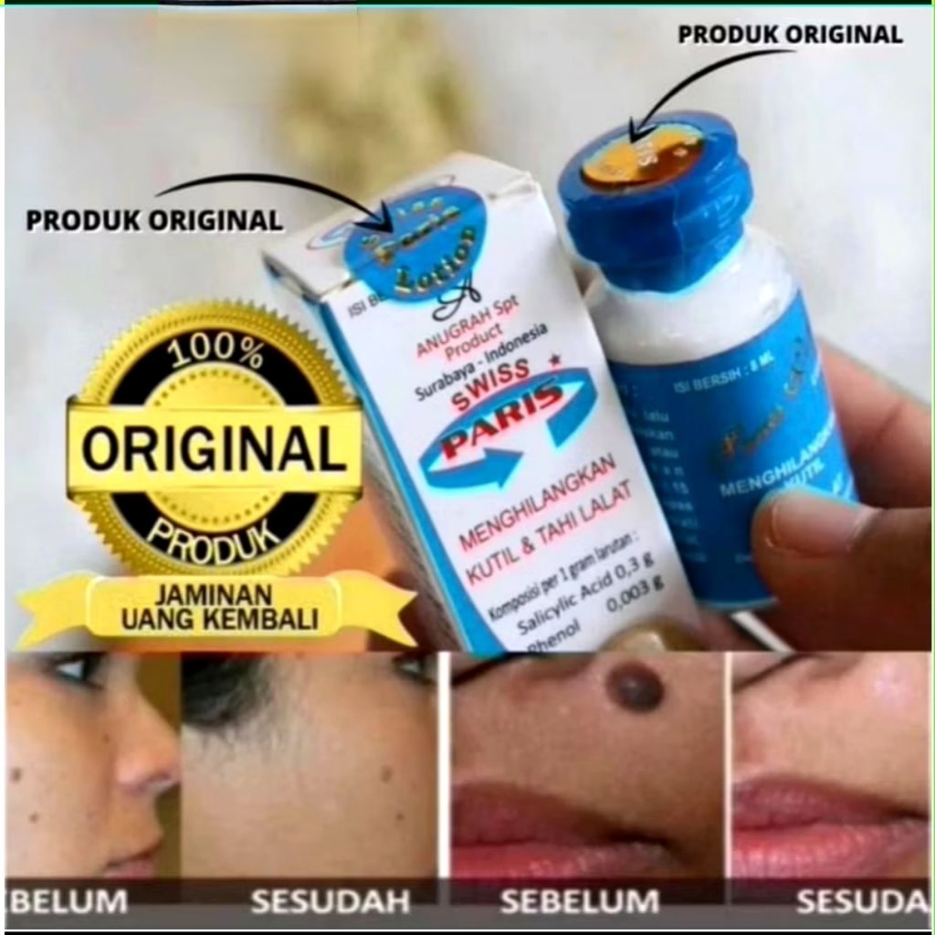 Salep Kutilat Salep Penghilang Kutil dan Tahi Lalat Permanen