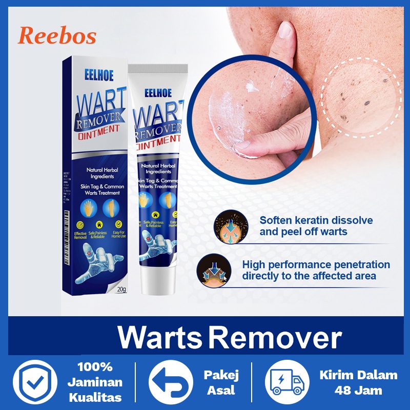 Reebos Penghilang Tahi Lalat Kutil Wart Remover Ointment Original Skin Tag Kutil Remover Ointment Cr