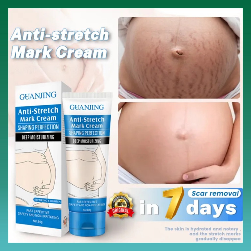 Krim stretch mark, krim penghilang stretch mark, krim kehamilan, perawatan penghilang stretch mark