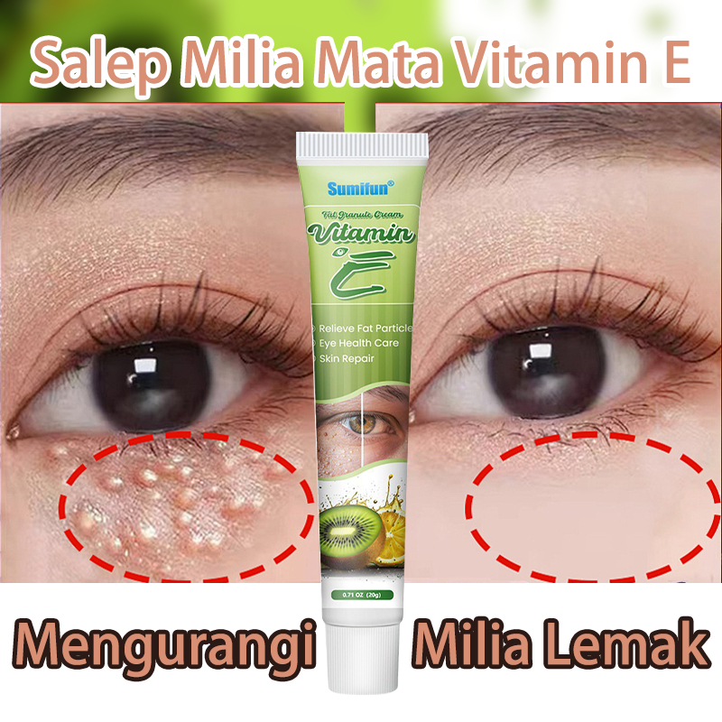 New Penghilang Milia Paling Ampuh Eye Cream Milia Remover Obat Milia Di Bawah Mata Krim Milia
