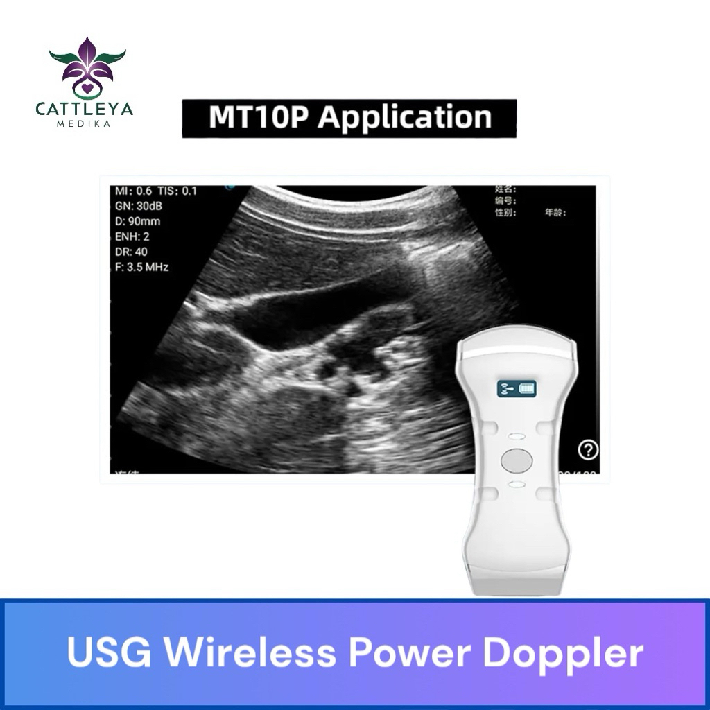 ULTRASOUND | USG Wireless Portable Power Doppler / USG Genggam Ultrasound Doppler