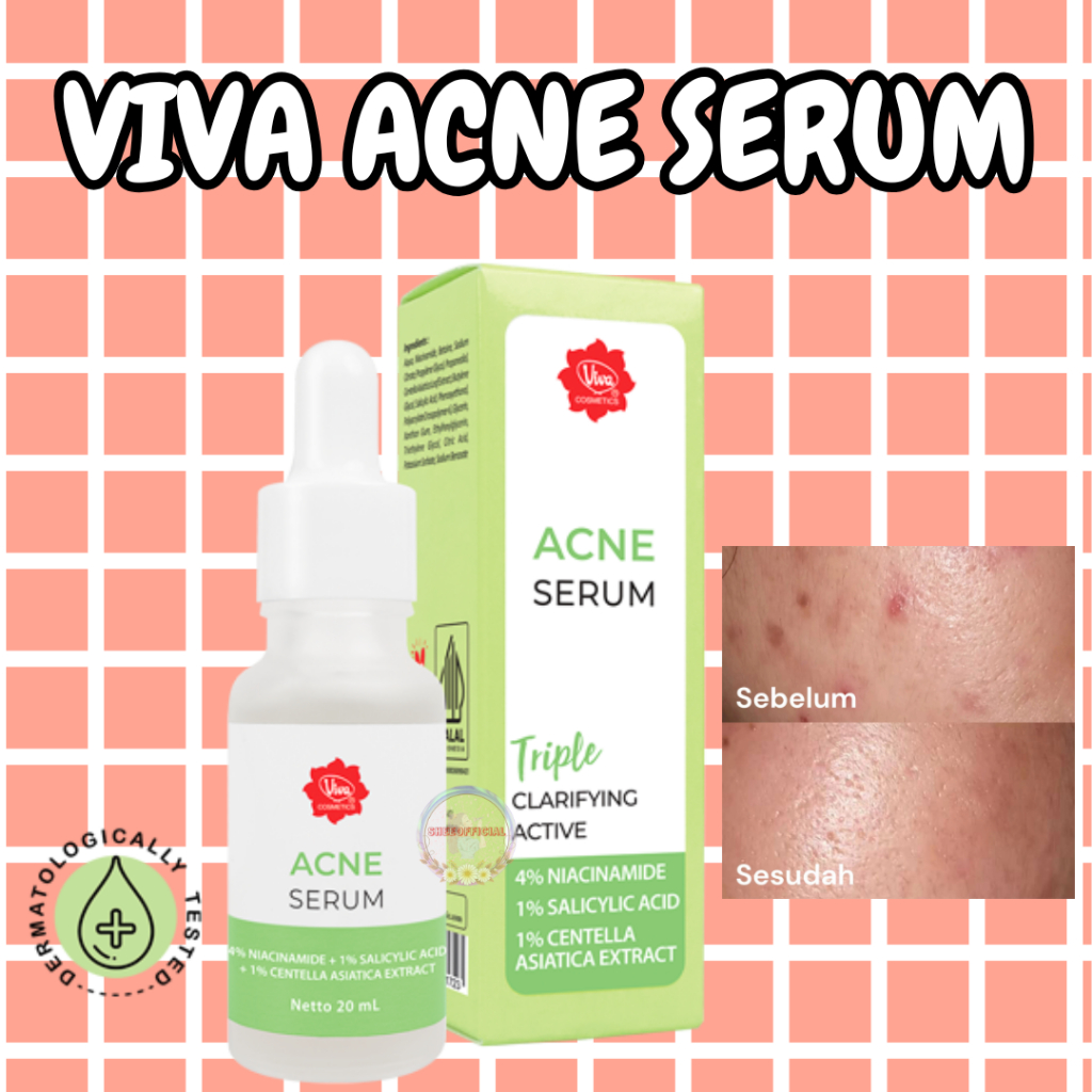 Viva Acne Serum | Menyamarkan Kemerahan Kulit Berjerawat Menghilangkan Bekas Noda Hitam Jerawat