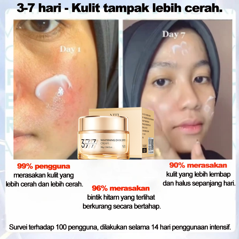 Krim pemutih wajah, krim penghilang flek hitam, krim flek hitam Starmembandel 30g, menghilangkan fle