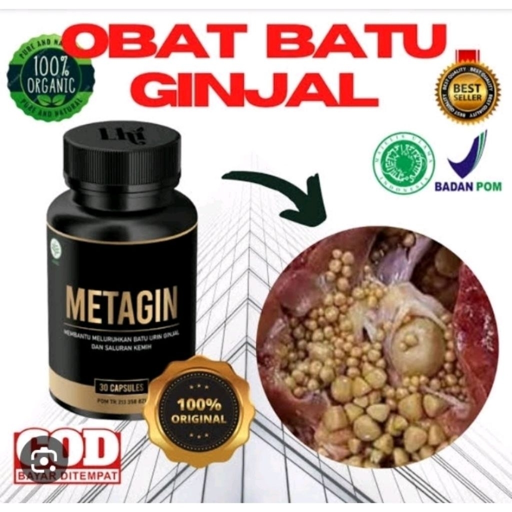 (TERLARIS) Metagin Obat Penghancur Batu Ginjal BPOM - Asli 100% Original