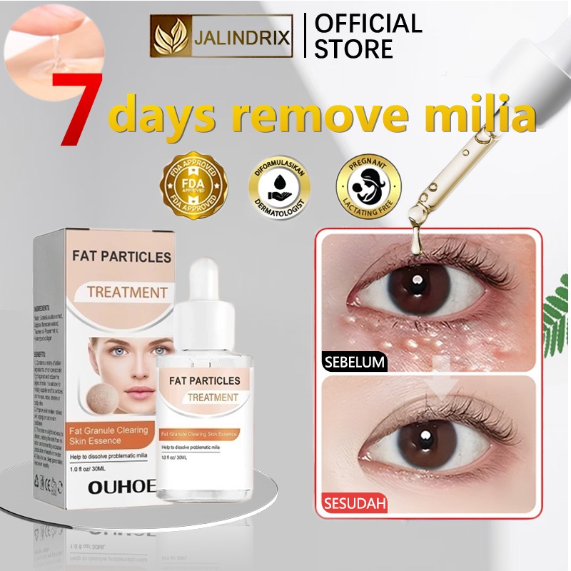 Jalindrix Serum Milia Penghilang Milia Di Bawah Mata Obat jerawat milia pada area mata ampuh milia d