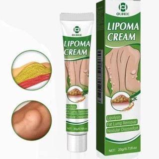 Lipoma Cream Obat Benjolan Subkutan Lipoma Removal Cream Obat Salep Benjolan Lipoma Ampuh Herbal sal
