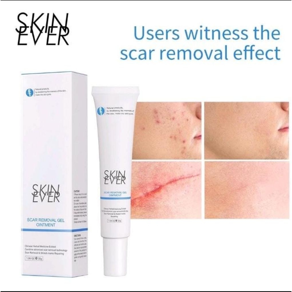 Skin Ever Scar Removal Gel Skin Ever Scar Removal Gel reduces acne
