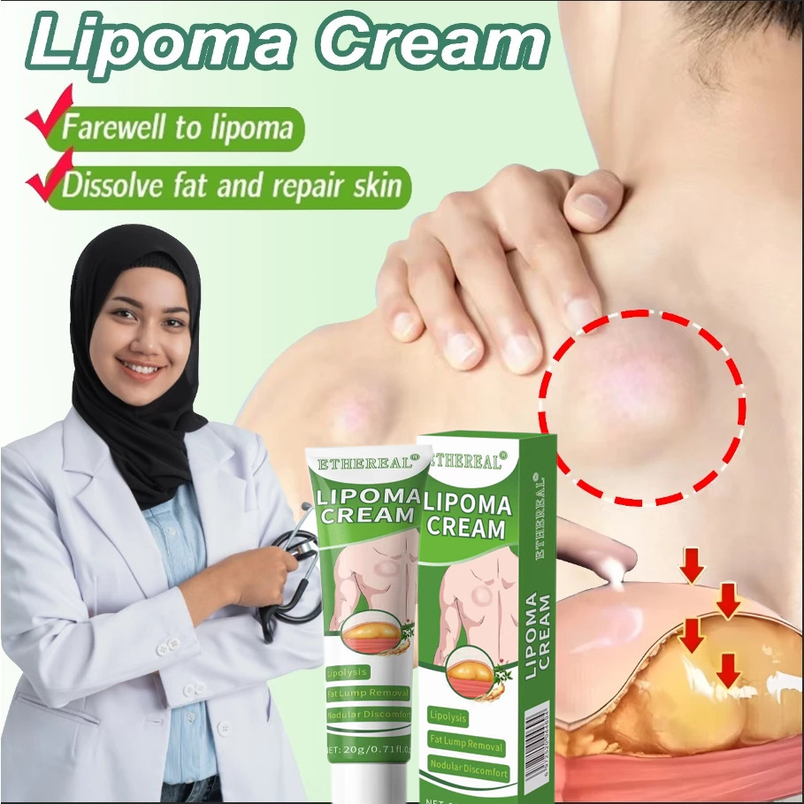 Lipoma Cream Obat Benjolan Lipoma Krim Benjolan Di Leher / Tangan / Ketiak / Benjolan Di Leher / Pun