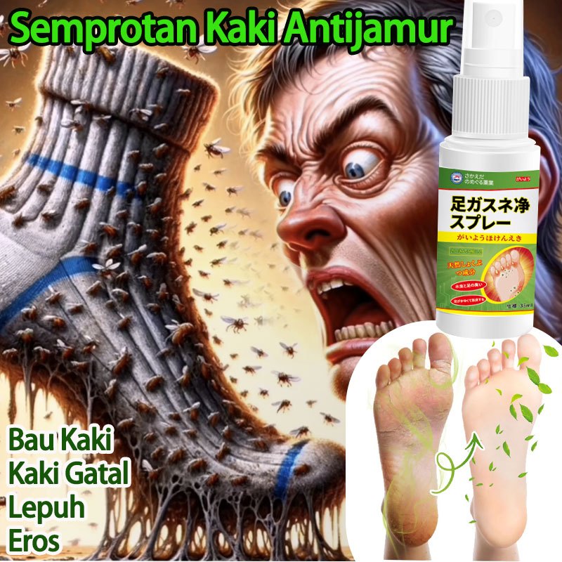 Deodorant kaki obat gatal jamur 35ml buat kaki pecah2 Solusi Bau Kaki Parah untuk atlet Tahan Lama 2