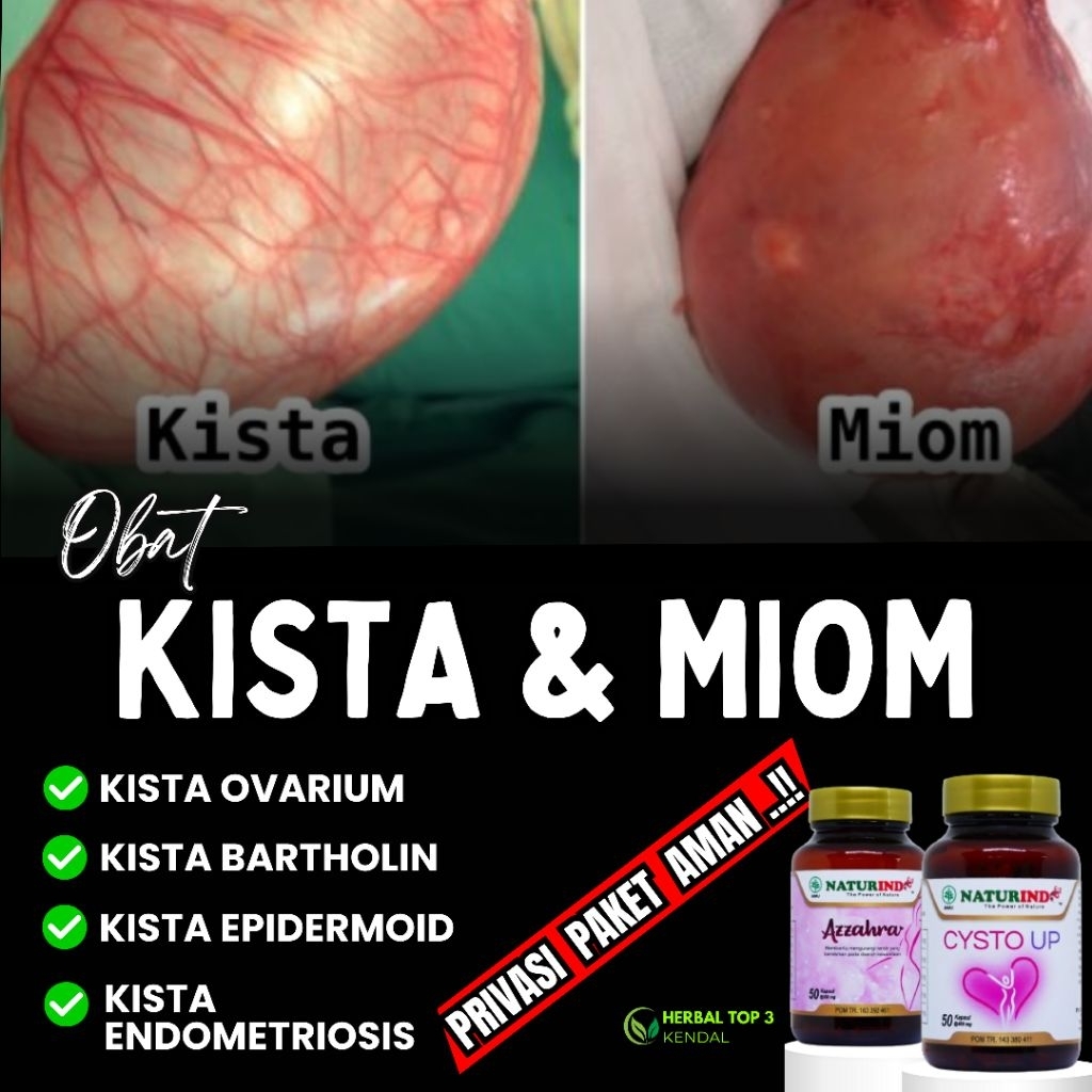 Obat Kista Miom Bartholin Ovarium Kista Endometriosis Detox Rahim Herbal Paling Ampuh