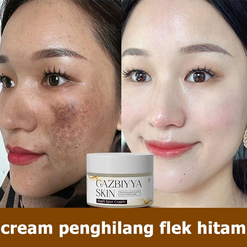 Krim flek hitam membandel bpom ori Krim flek hitam ampuh dan cepat 30g krim penghilang flek hitam bp