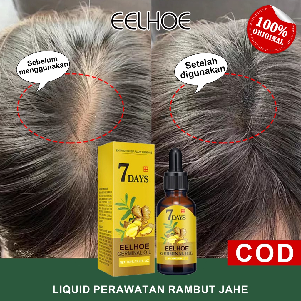 EELHOE【100%ORI】Ginger Hair Growth Serum 7 Days Ginger Germinal Oil Anti Ketombe dan Rontok Esensi An