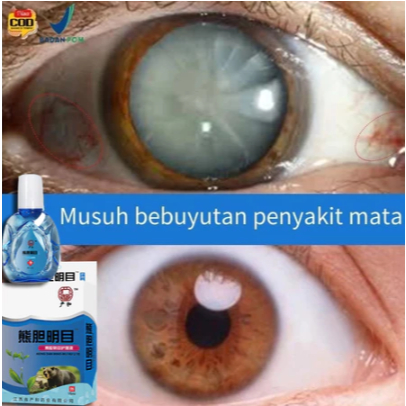 Obat Tetes Mata Obat Mata Katarak Eye Drop Obat Mata Buram Obat Mata Berlemak Tetes Mata Herbal Mata