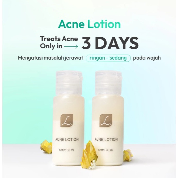 Treatment Lotion Larissa/Acne Lotion Larissa