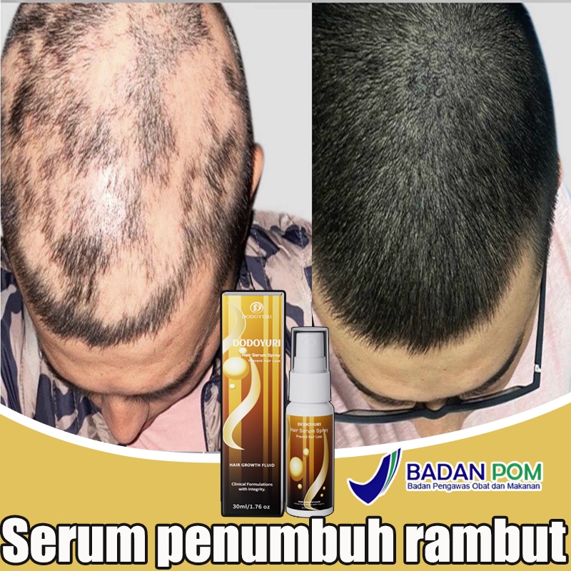 Serum penumbuh rambut Penumbuh rambut botak Hair serum penumbuh rambut Penumbuh rambut cepat dan teb