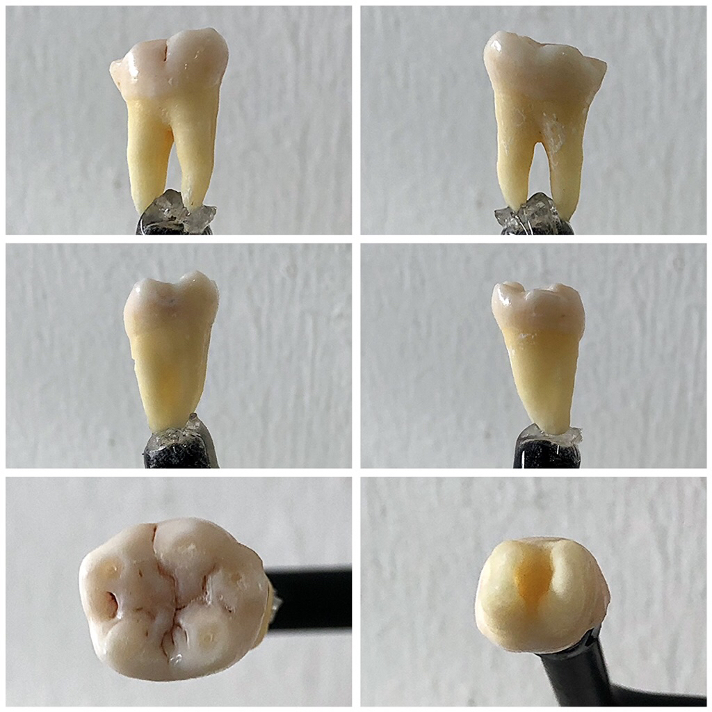 Gigi Geraham Molar Atas Bawah Asli Praktikum