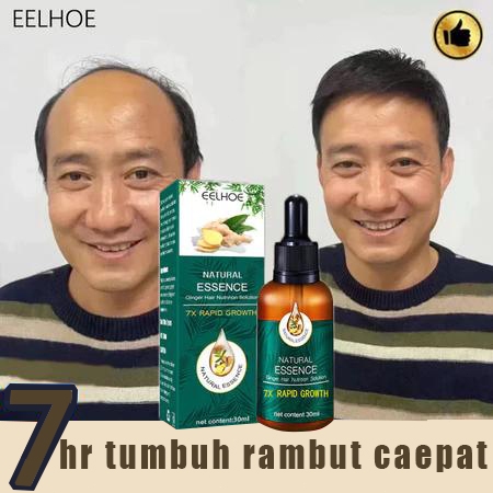 hair tonic-penumbuh rambut botak Menyehatkan Kulit Kepala&Meningkatkan Regenerasi Rambut/serum penum