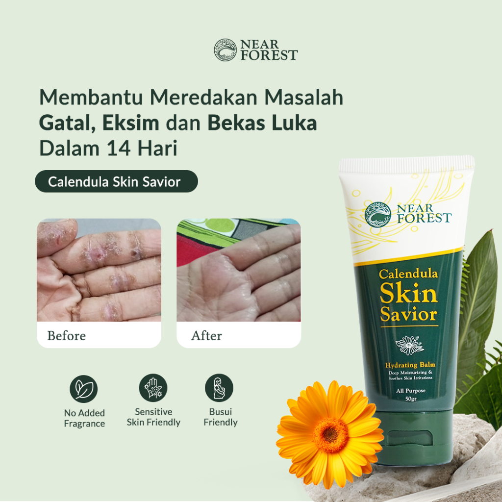 Nearforest Calendula Skin Savior Hydrating Balm Krim Pereda Gatal Eksim dan Kulit Sensitif