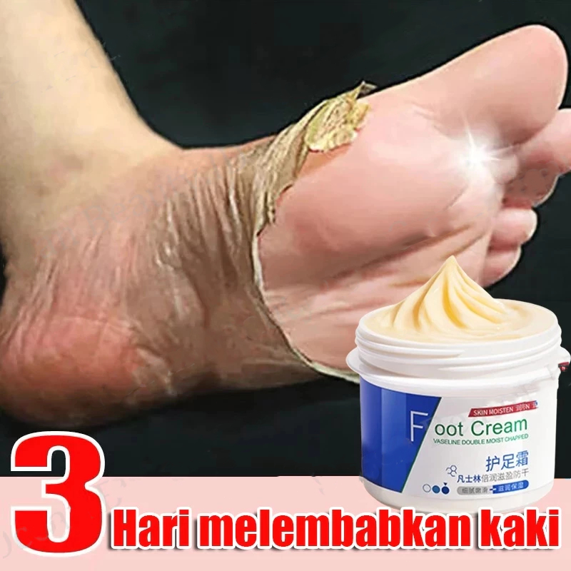 Cream Kaki pecah dan kering Penghalus kaki kasar dan pecah Foot cream Pelembab kaki Obat kaki kering