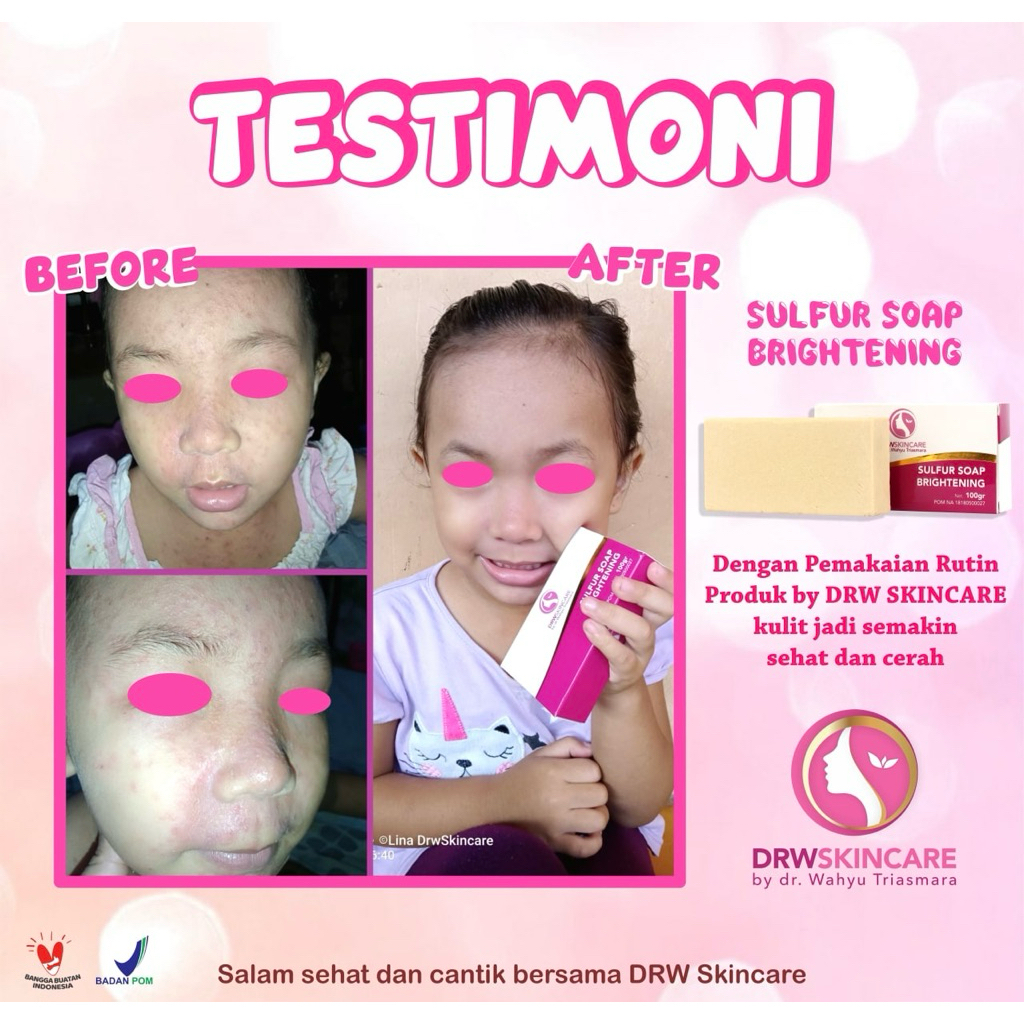 SABUN SULFUR / SULFUR MILK DRW SKINCARE / SULFUR SOAP