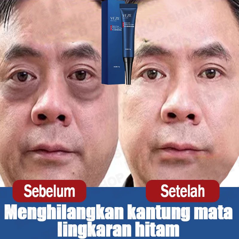 Cream Penghilang Kantung Mata Krim Mata Panda Dan Kantung Mata Cream Mata Panda Dan Kerutan Eye Crea